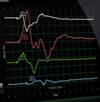IONM small pic